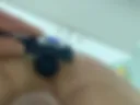 Anal