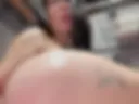 anal