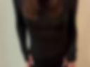 Legs