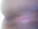 Anus