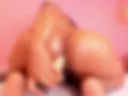ANAL