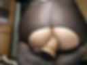 Anal cum
