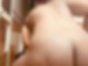 Anal