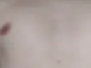 866