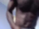 Nut on boxers hand