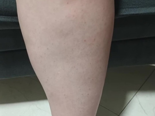 Hi