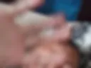 Anus 124
