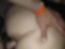 Anal