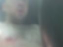 Penis