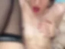 Anal