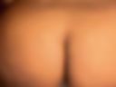 Anal