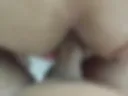 anal