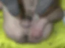 hairy hole