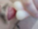 Vagina