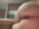 Anal