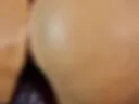 Anal