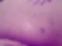 anal
