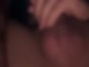 Anal