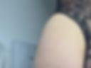 ANAL