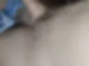 Lifting the penis