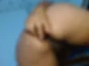 anal