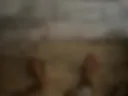 Leg