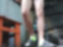 Dp
