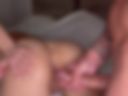 Anal