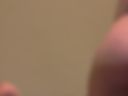 anal