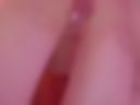 ICE on boobs
