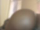 Anal winks