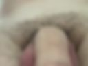 penis close up