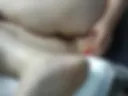 Anal