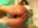 anal